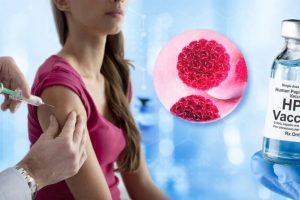 واکسن HPV : سپر دفاعی در برابر زگیل های تناسلی و سرطان